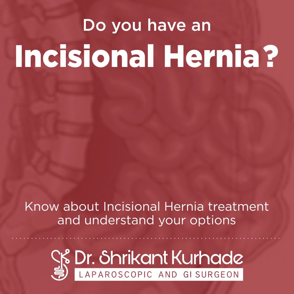 Dr Shrikant Kurhade Laparoscopic Gastroenterologist Bariatric Hernia Piles Specialist In Pcmc